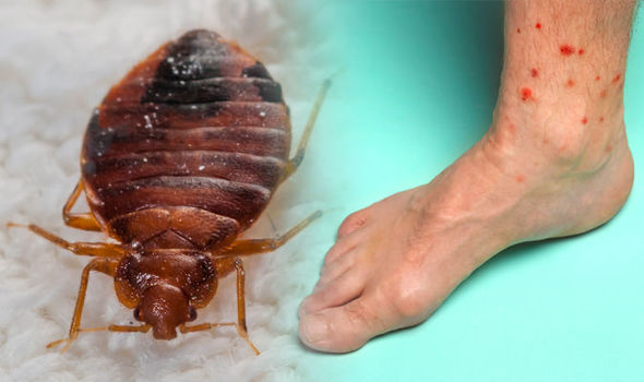 Bed bug eggs can severely affect your health!